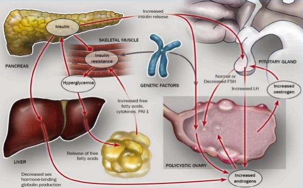 Yoga for PCOS: A gentle support to women's health - Image 3: Intra body relationships in PCOS